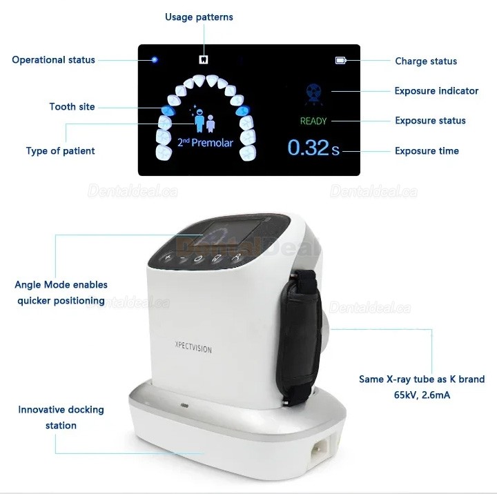 XVbeam2000 Dental Portable Dental X-Ray Machine Handheld High Frequency XRay Unit